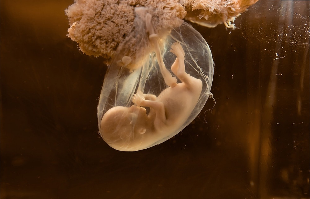 Early fetal development.